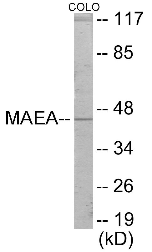 Western blot analysis of extracts from COLO205 cells, using MAEA Antibody. The lane on the right is treated with the synthesized peptide.