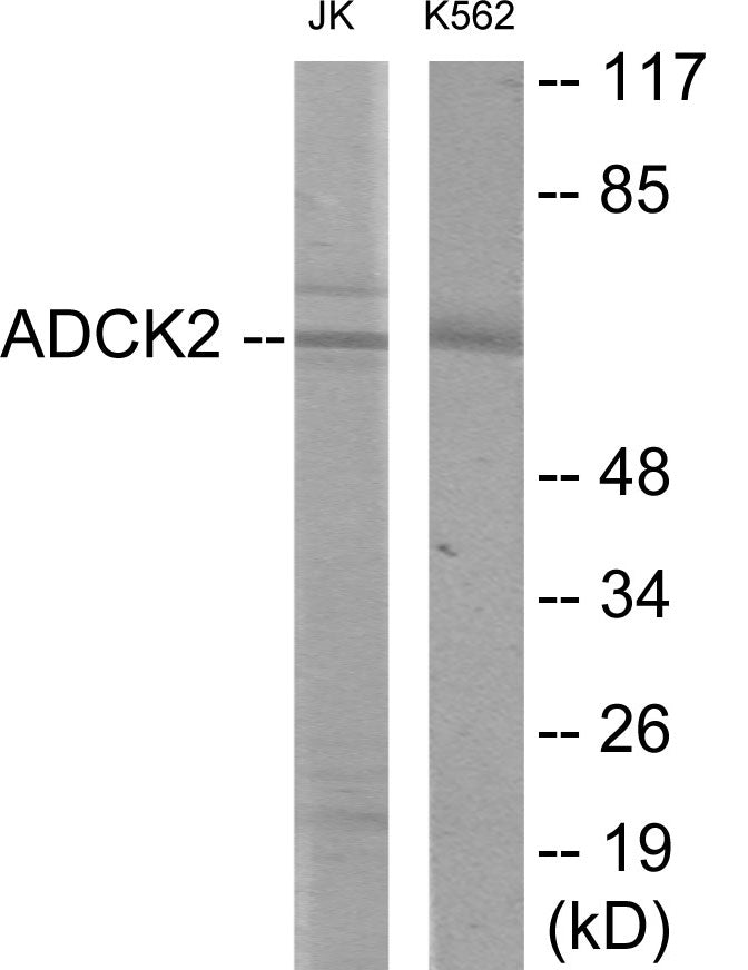 Western blot analysis of extracts from Jurkat/K562 cells, using ADCK2 Antibody. The lane on the right is treated with the synthesized peptide.