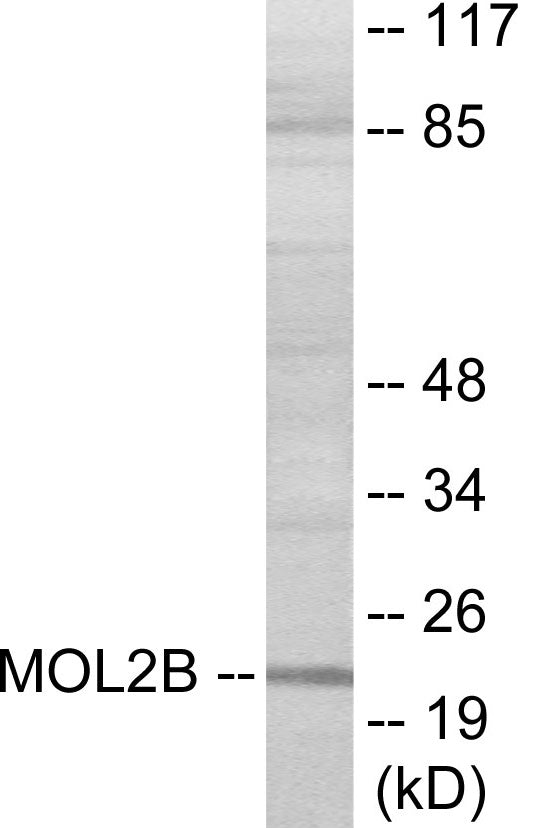 Western blot analysis of extracts from COLO cells, using MOBKL2B Antibody. The lane on the right is treated with the synthesized peptide.