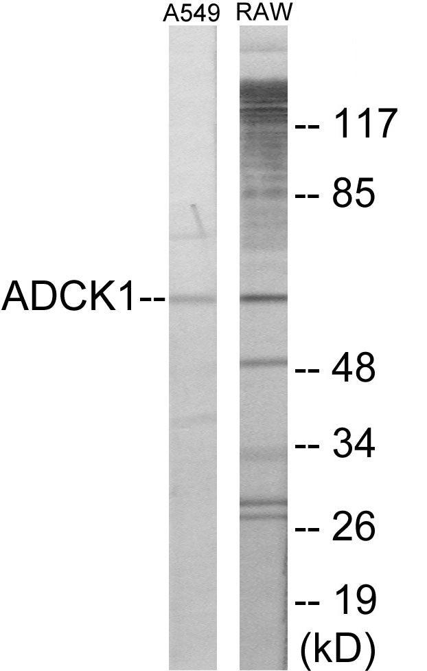 Western blot analysis of extracts from A549/RAW264.7 cells, using ADCK1 Antibody. The lane on the right is treated with the synthesized peptide.