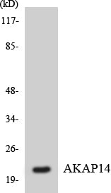 Western blot analysis of extracts from Jurkat/K562/HuvEc cells, using AKAP14 Antibody.