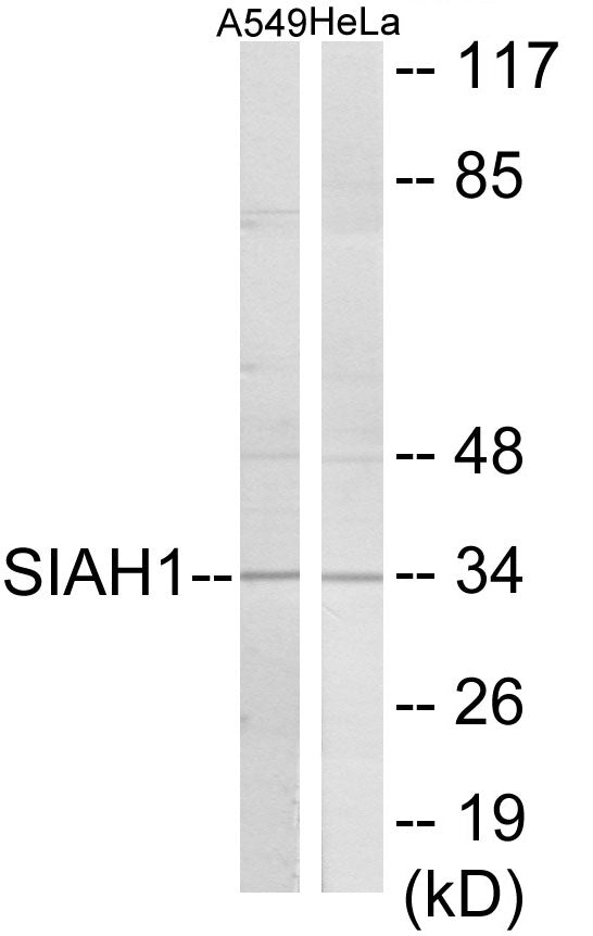 Western blot analysis of extracts from A549/HeLa cells, using SIAH1 Antibody. The lane on the right is treated with the synthesized peptide.