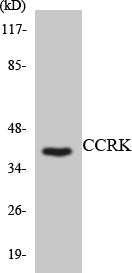 Western blot analysis of extracts from RAW264.7 cells, using CCRK Antibody.