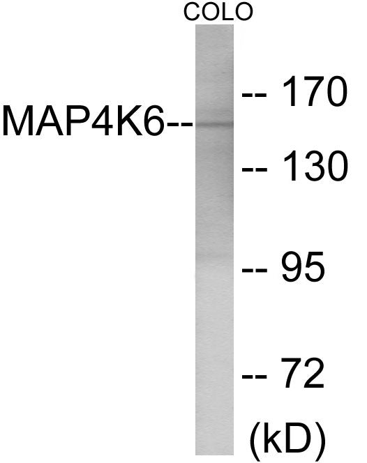 Western blot analysis of extracts from COLO cells, using MAP4K6 Antibody. The lane on the right is treated with the synthesized peptide.