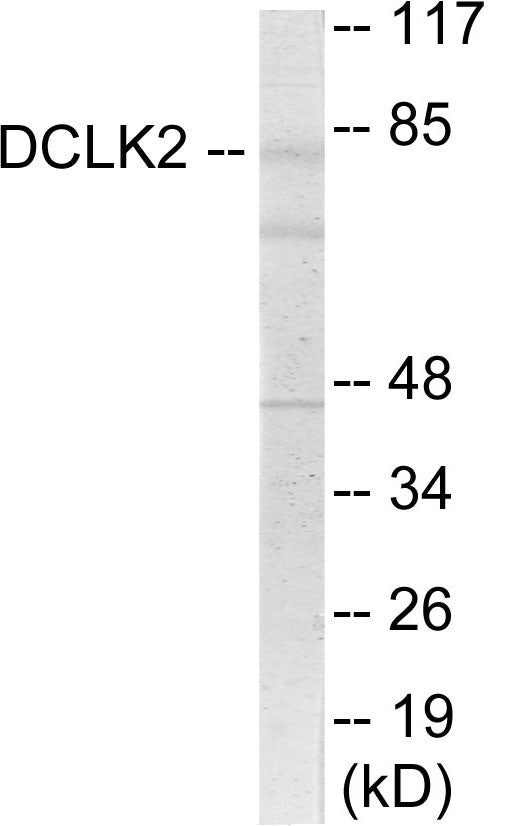 Western blot analysis of extracts from HepG2 cells, using DCLK2 Antibody. The lane on the right is treated with the synthesized peptide.