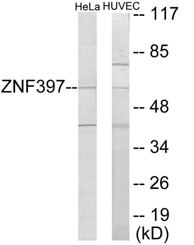 Western blot analysis of extracts from HeLa/HuvEc cells, using ZNF397 Antibody. The lane on the right is treated with the synthesized peptide.