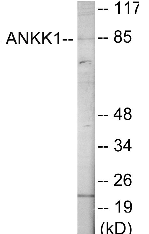 Western blot analysis of extracts from HeLa cells, using ANKK1 Antibody. The lane on the right is treated with the synthesized peptide.