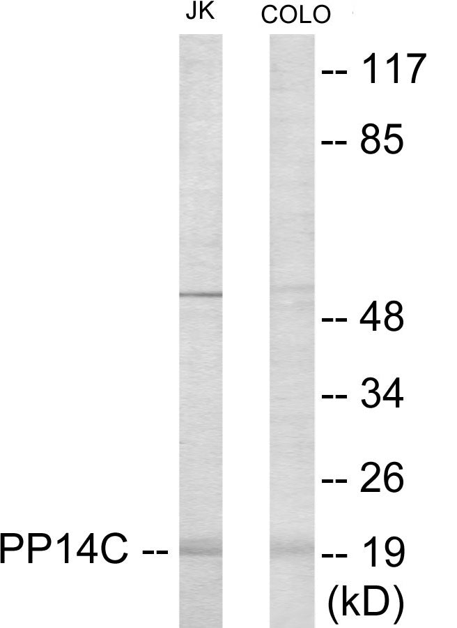 Western blot analysis of extracts from Jurkat/COLO205 cells, using PPP1R14C Antibody. The lane on the right is treated with the synthesized peptide.