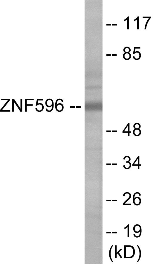 Western blot analysis of extracts from Jurkat cells, using ZNF596 Antibody.