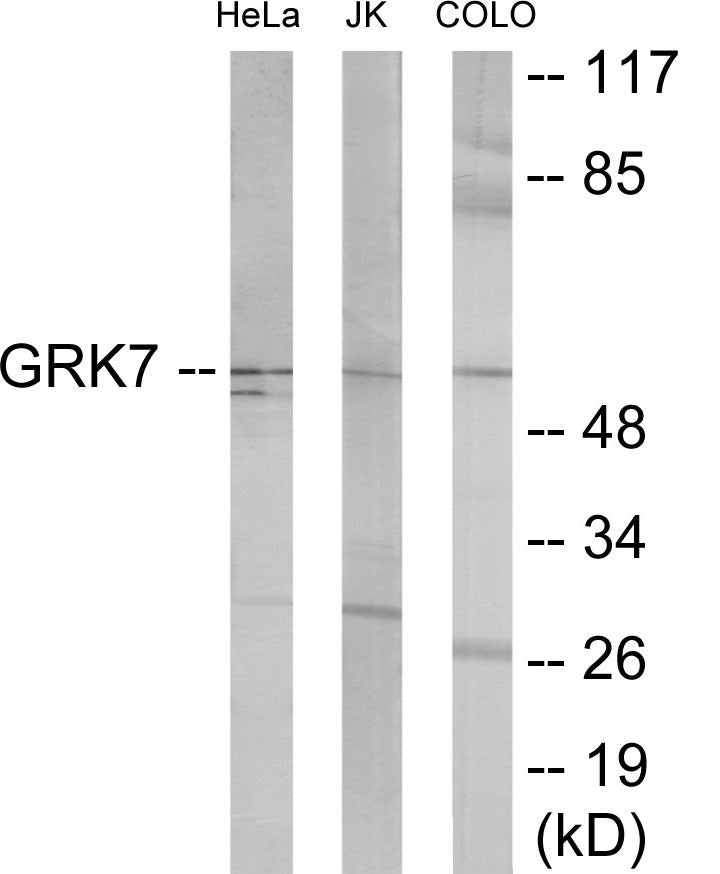 Western blot analysis of extracts from COLO205/Jurkat/HeLa cells, using GRK7 Antibody. The lane on the right is treated with the synthesized peptide.