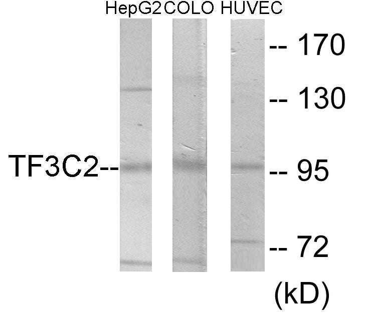 Western blot analysis of extracts from HepG2/COLO205/HuvEc cells, using TF3C2 Antibody. The lane on the right is treated with the synthesized peptide.