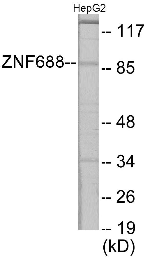 Western blot analysis of extracts from HepG2 cells, using ZNF785 Antibody. The lane on the right is treated with the synthesized peptide.