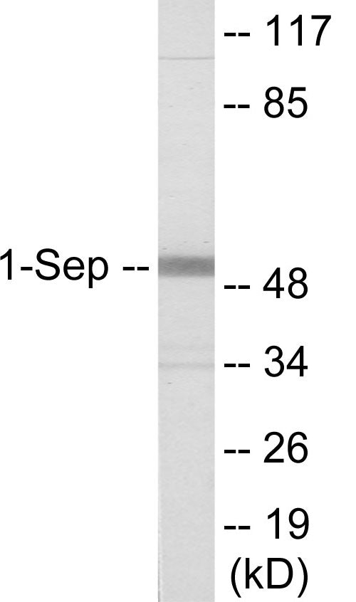 Western blot analysis of extracts from Jurkat cells, using SEPT1 Antibody. The lane on the right is treated with the synthesized peptide.