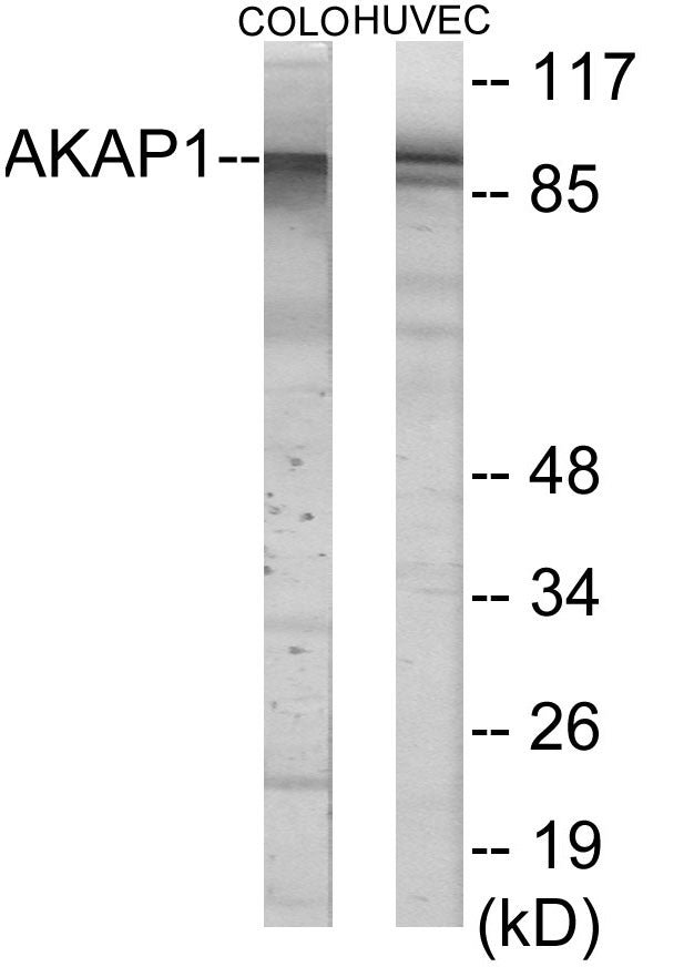 Western blot analysis of extracts from HuvEc/COLO cells, using AKAP1 Antibody.