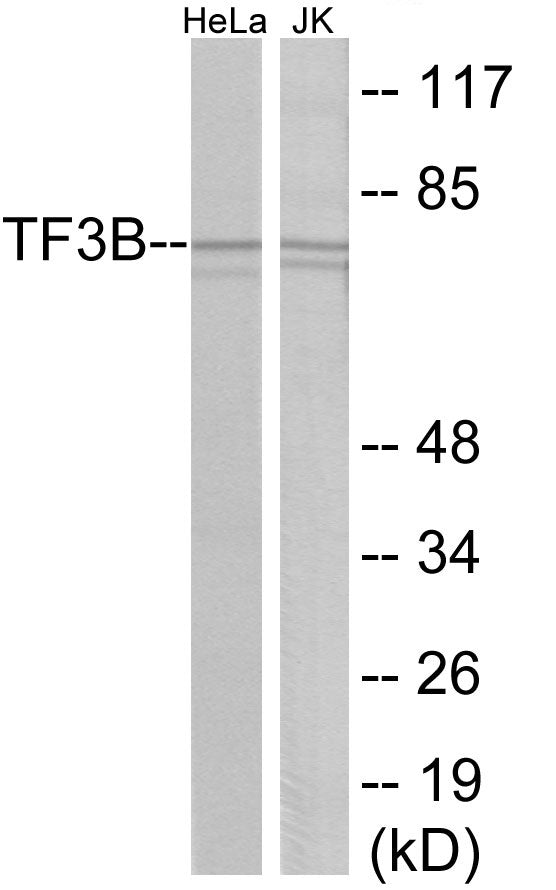 Western blot analysis of extracts from HeLa/Jurkat cells, using TF3B Antibody.