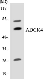 Western blot analysis of extracts from HepG2 cells, using ADCK4 Antibody.