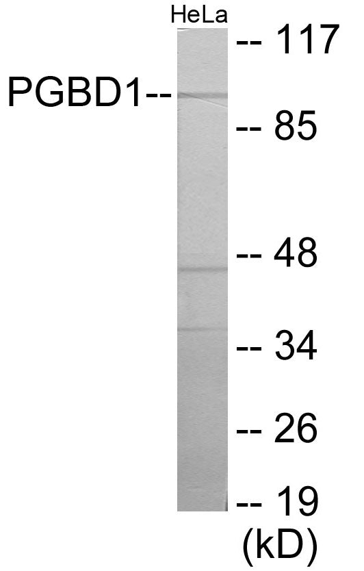 Western blot analysis of extracts from HeLa cells, using PGBD1 Antibody. The lane on the right is treated with the synthesized peptide.