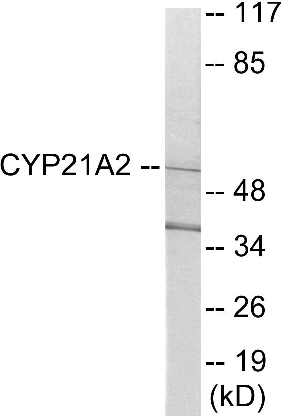 Western blot analysis of extracts from 293 cells, using Cytochrome P450 21A2 Antibody. The lane on the right is treated with the synthesized peptide.