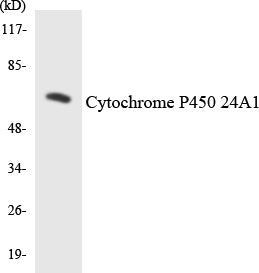 Western blot analysis of extracts from JurKat cells, using Cytochrome P450 24A1 Antibody. The lane on the right is treated with the synthesized peptide.