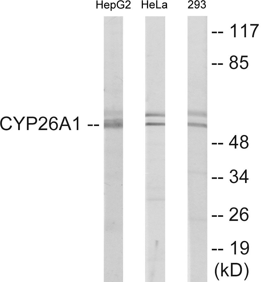 Western blot analysis of extracts from HepG2/HeLa/293 cells, using Cytochrome P450 26A1 Antibody. The lane on the right is treated with the synthesized peptide.
