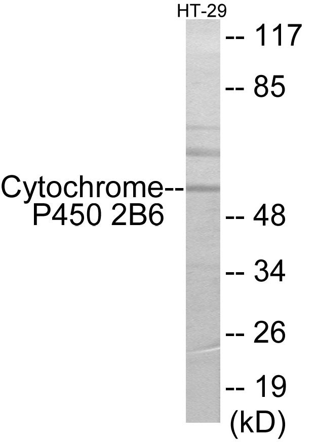 Western blot analysis of extracts from HT-29 cells, using Cytochrome P450 2B6 Antibody. The lane on the right is treated with the synthesized peptide.