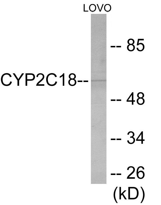 Western blot analysis of extracts from LOVO cells, using Cytochrome P450 2C8/9/18/19 Antibody. The lane on the right is treated with the synthesized peptide.