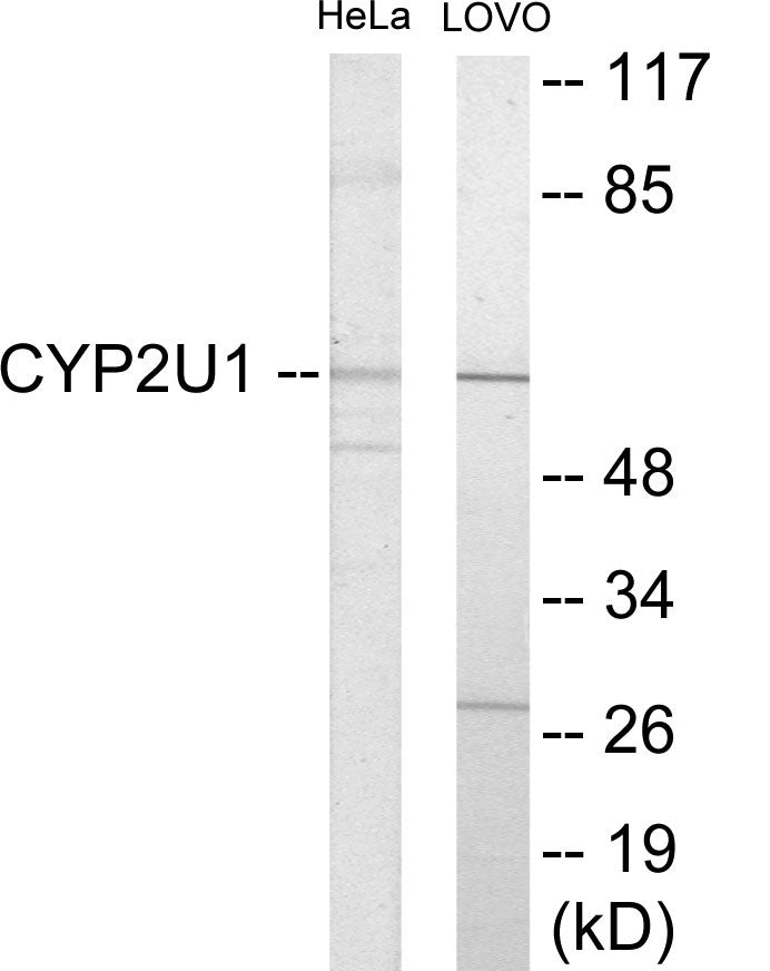 Western blot analysis of extracts from HeLa/Lovo cells, using Cytochrome P450 2U1 Antibody. The lane on the right is treated with the synthesized peptide.