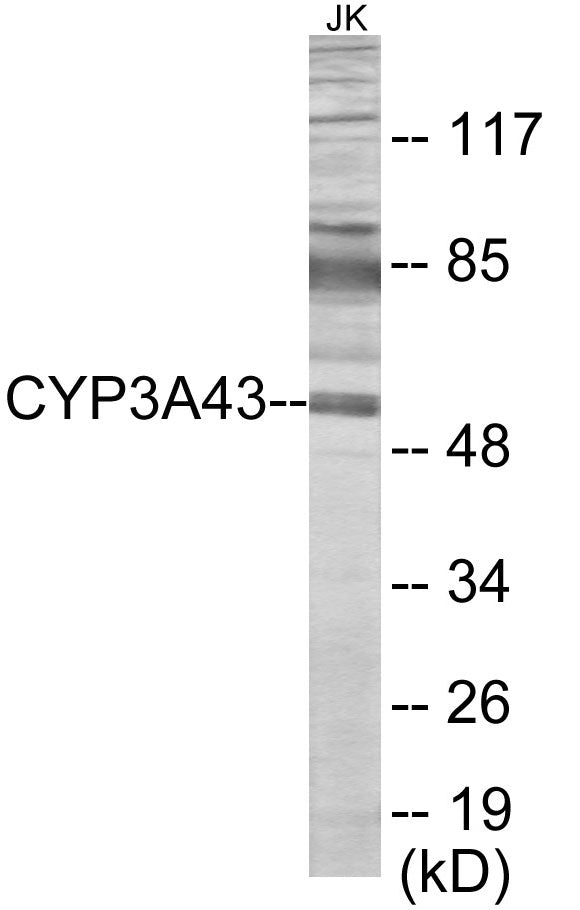 Western blot analysis of extracts from Jurkat cells, using Cytochrome P450 3A43 Antibody. The lane on the right is treated with the synthesized peptide.