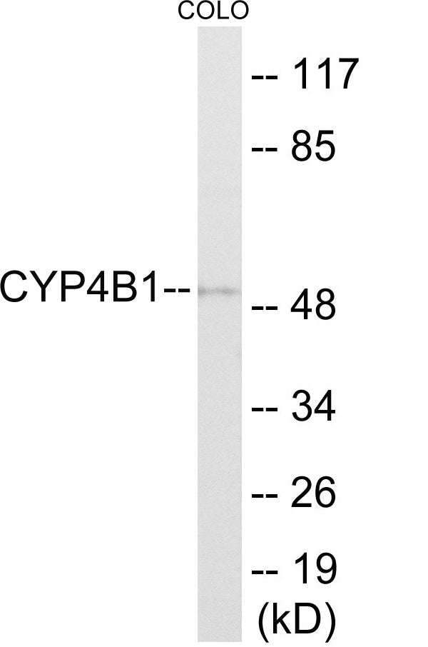 Western blot analysis of extracts from COLO cells, using Cytochrome P450 4B1 Antibody.