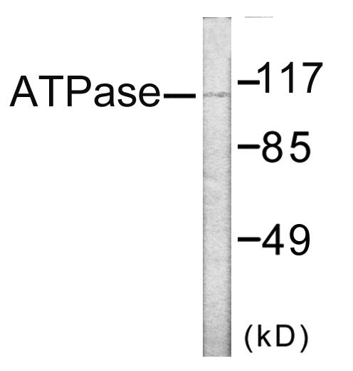 Western blot analysis of extracts from 293 cells, treated with PMA 125ng/ml 30’, using ATPase Antibody.