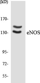 Western blot analysis of extracts from Jurkat cells, using eNOS Antibody. The lane on the right is treated with the synthesized peptide.