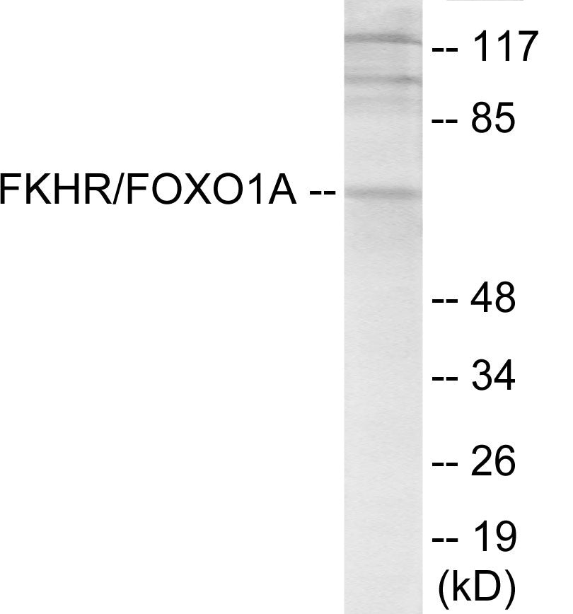 Western blot analysis of extracts from HeLa cells, treated with EGF+Serum, using FKHR Antibody.