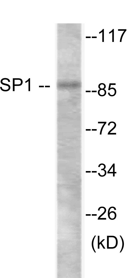 Western blot analysis of extracts from LOVO cells, using SP1 Antibody.