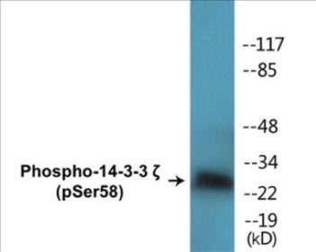 Western blot analysis of extracts from NIH-3T3 cells treated with UV 30', using 14-3-3 zeta (Phospho-Ser58) Antibody.