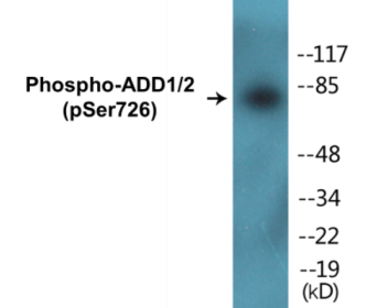 Western blot analysis of extracts from HeLa cells treated with Forskolin 40nM 30', using ADD1 (Phospho-Ser726) Antibody.