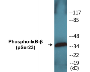 Western blot analysis of extracts from HeLa cells treated with TNF-a 20ng/ml 5', using IkappaB-beta (Phospho-Ser23) Antibody.