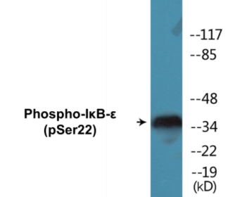 Western blot analysis of extracts from Jurkat cells treated with TNF-a 20ng/ml 30', using IkappaB-epsilon (Phospho-Ser22) Antibody.