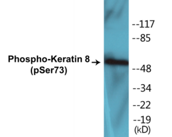 Western blot analysis of extracts from 293 cells treated with Etoposide 25uM 60', using Keratin 8 (Phospho-Ser73) Antibody.