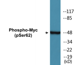 Western blot analysis of extracts from 293 cells treated with Forskolin 40nM 30', using Myc (Phospho-Ser62) Antibody.