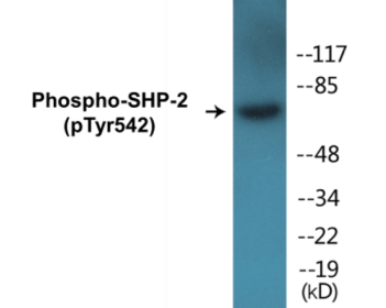 Western blot analysis of extracts from A431 cells, using SHP-2 (Phospho-Tyr542) Antibody.