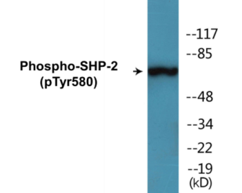 Western blot analysis of extracts from A431 cells, using SHP-2 (Phospho-Tyr580) Antibody.