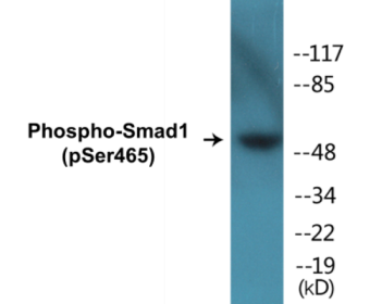 Western blot analysis of extracts from HeLa cells treated with Serum 10% 15', using Smad1 (Phospho-Ser465) Antibody.