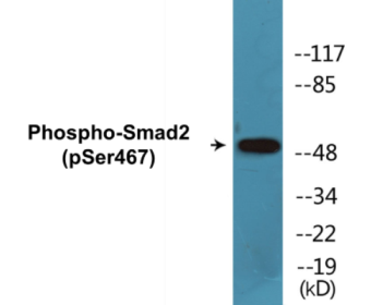 Western blot analysis of extracts from HepG2 cells treated with PMA 125ng/ml 15', using Smad2 (Phospho-Ser467) Antibody.