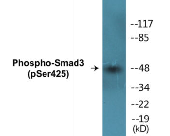 Western blot analysis of extracts from NIH-3T3 cells treated with IGF-I 100ng/ml 10', using Smad3 (Phospho-Ser425) Antibody.