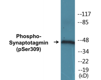 Western blot analysis of extracts from 293 cells treated with Sobital 0.4M 30', using Synaptotagmin (Phospho-Ser309) Antibody.