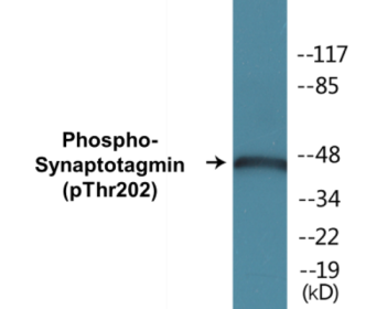 Western blot analysis of extracts from 293 cells treated with Forskolin 40nM 30', using Synaptotagmin (Phospho-Thr202) Antibody.