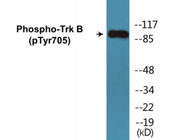 Western blot analysis of extracts from mouse kidney, using Trk B (Phospho-Tyr705) Antibody.