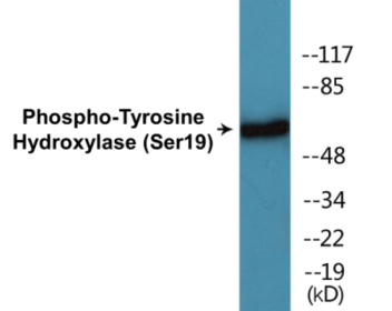 Western blot analysis of extracts from 293 cells treated with Insulin 0.01U/ml 30', using Tyrosine Hydroxylase (Phospho-Ser19) Antibody.