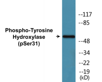 Western blot analysis of extracts from 293 cells treated with UV 15', using Tyrosine Hydroxylase (Phospho-Ser31) Antibody.