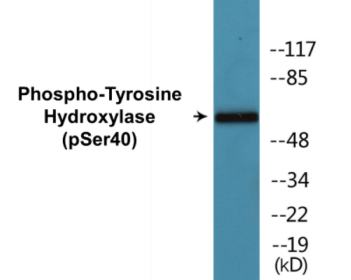Western blot analysis of extracts from RAW264.7 cells treated with UV 30', using Tyrosine Hydroxylase (Phospho-Ser40) Antibody.